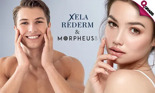 Xela Rederm & Morpheus Treatment for Ladies & Men!